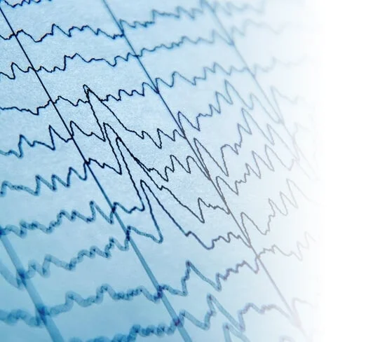 A close view of recorded brainwave traces.